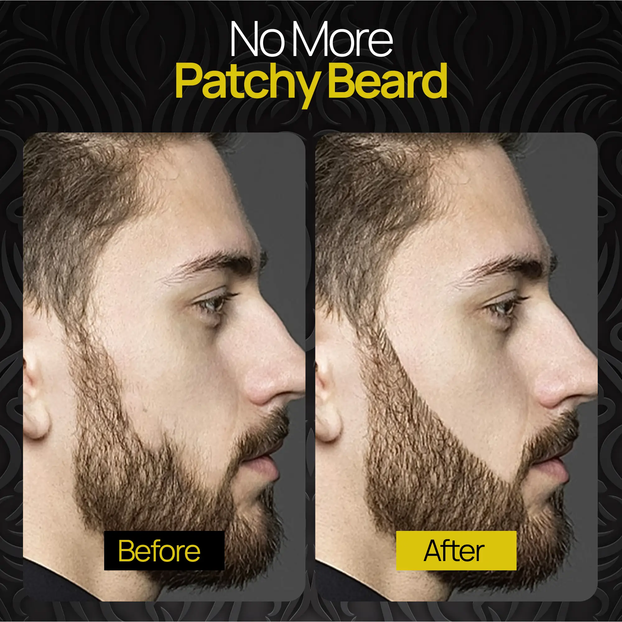SELZALOT 4-Tip Beard Filler Pen Kit - Waterproof, Sweat-Proof, Long-Lasting Coverage for a Fuller Beard with Brush by Selzalot